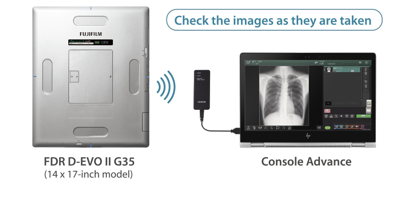 Fujifilm Portable X-ray Unit FDR Xair