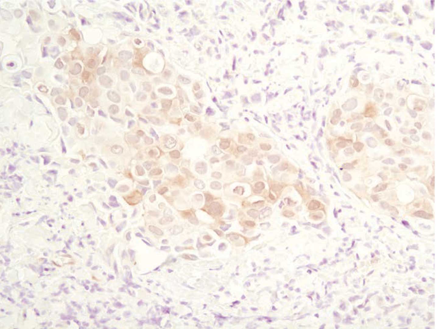 CST b2g1 IHC