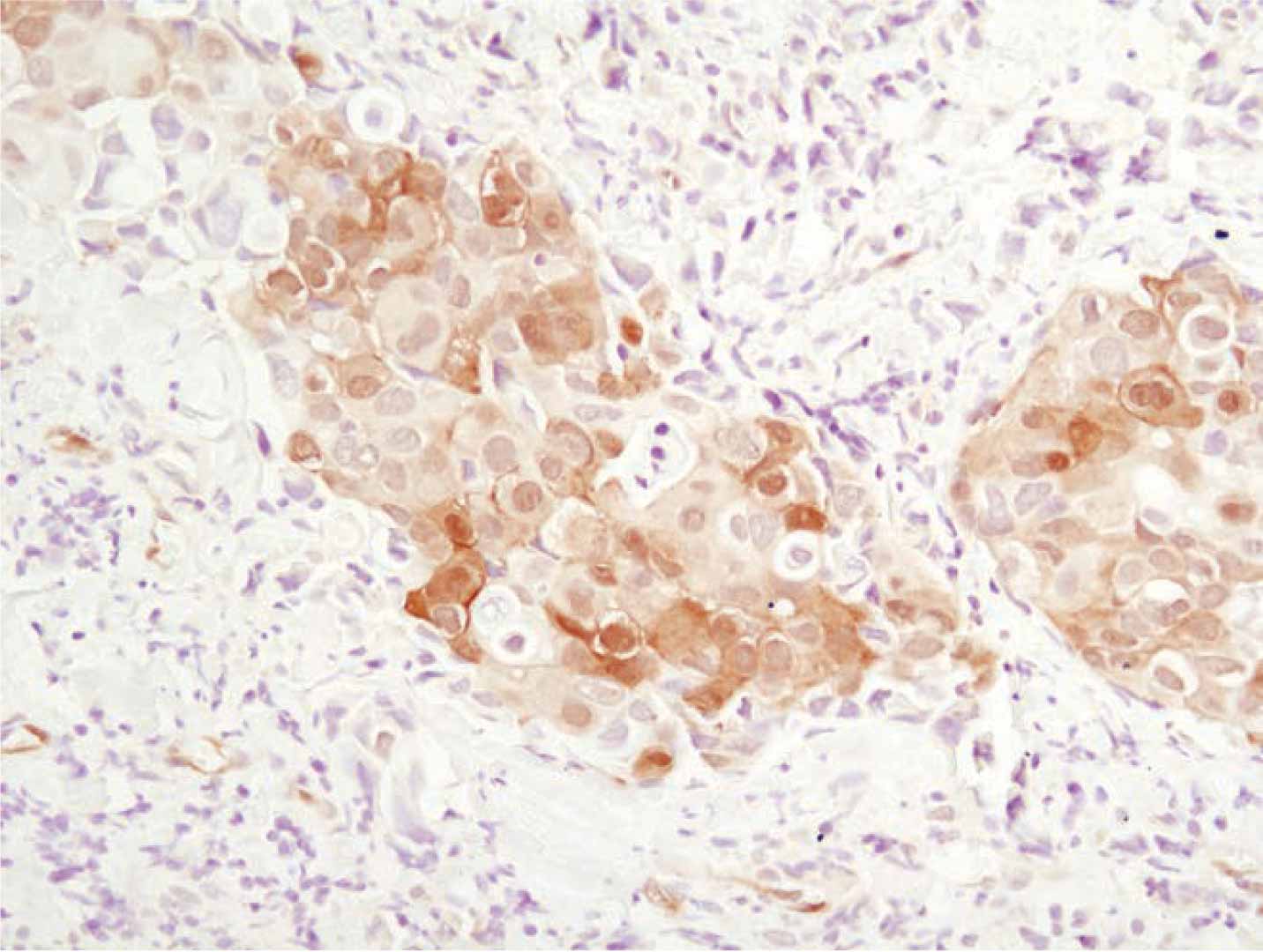CST b2g1 IHC