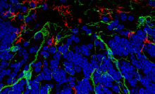 NPI Flyer- Global (February) 2026, EN-02