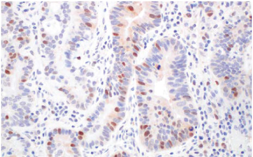 MAR-Rad51-(F4L4Y)-Rabbit-Monoclonal