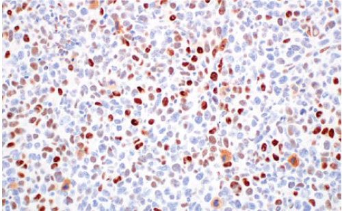 MAR-p21-Waf1-Cip1-(F7S9M)-Rabbit-Monoclonal