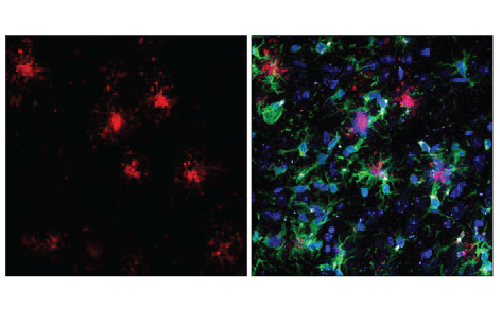 May – beta-Amyloid (1-40) (D8Q7I) Horse Chimeric Monoclonal Antibody#77438-8 Two-panel fluorescence microscopy image: left panel shows red fluorescent signals; right panel is a multi-color composite (green, blue, magenta) of stained cells on a dark background.