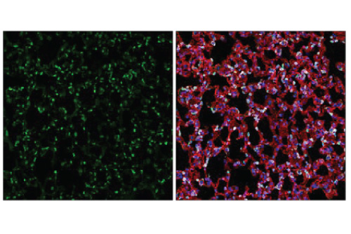 cst-npi-june-2 Two-panel fluorescence microscopy image: left panel shows green-labeled cells, right panel shows red and blue-stained cells (overlay of markers).