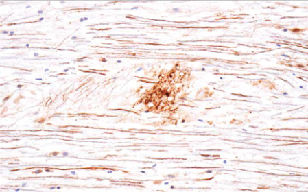 cst-npi-aug-1
