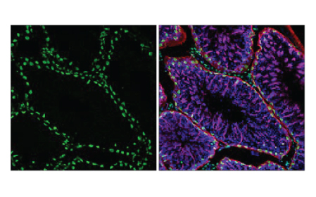 cst-npi-aug-2